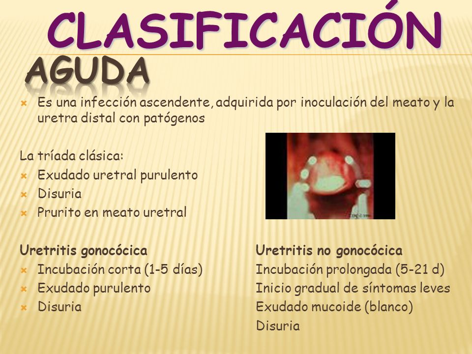 sintomas de uretritis cronica